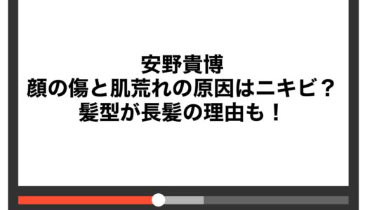 安野貴博の顔の傷と肌荒れの原因はニキビ？髪型が長髪の理由も！